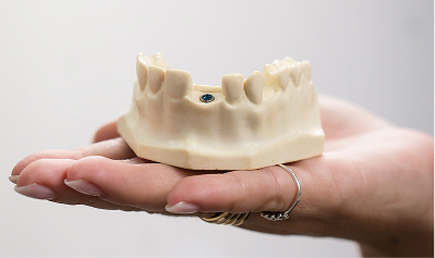 SWOSA_HP_Dental-Implants_Mobile